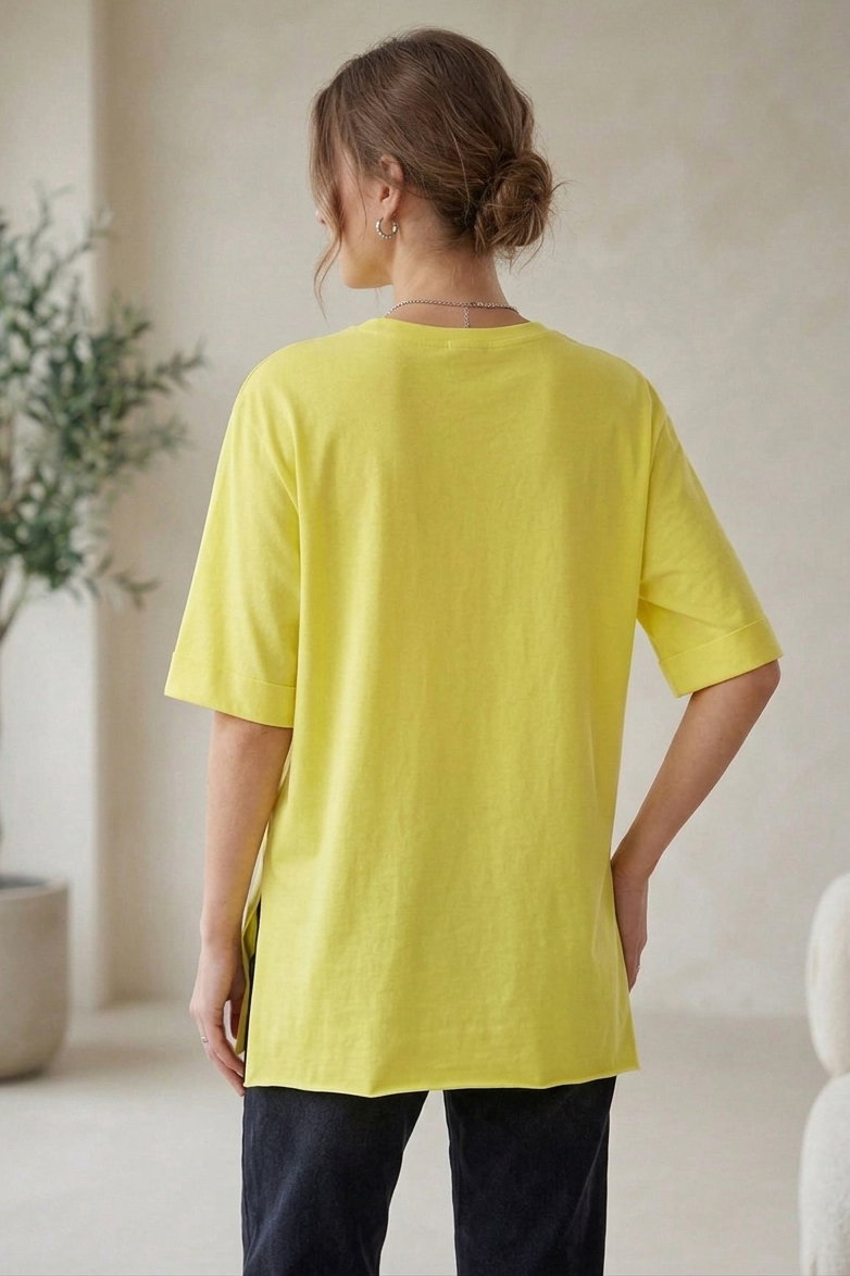 Yırtmaçlı Baskılı Kısa Kollu Tunik Sari - 1322-SARI - 3